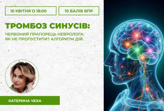 тромбоз синусв