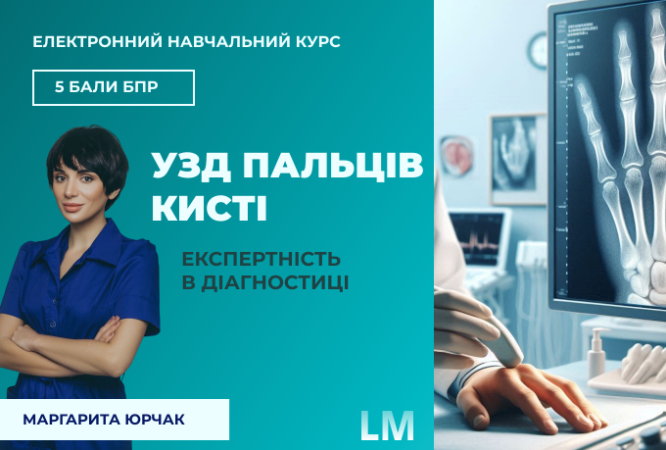 узд-пальців-кисті-ЕНК-1