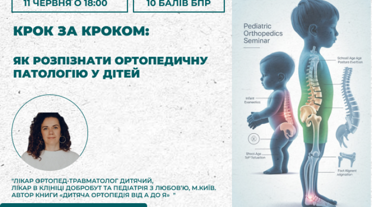 майстер клас для дитячих ортопедів майстер клас для дитячих ортопедів