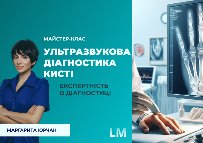 лінк лінк