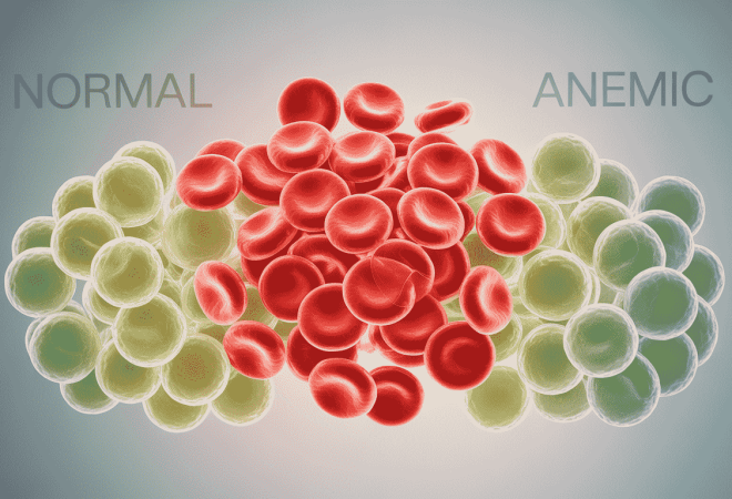 анемія хронічного генезу (1)