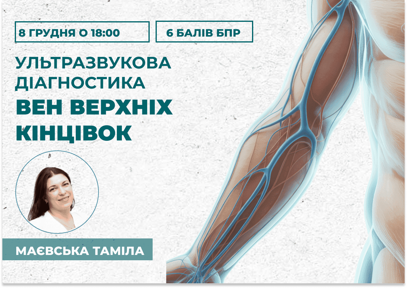 Ультразвукова діагностика вен ве