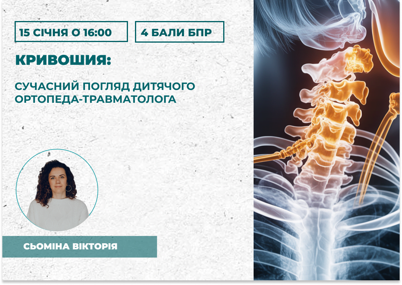 Ультразвукова діагностика кульшо