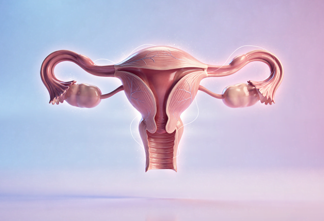 міома матки (1)