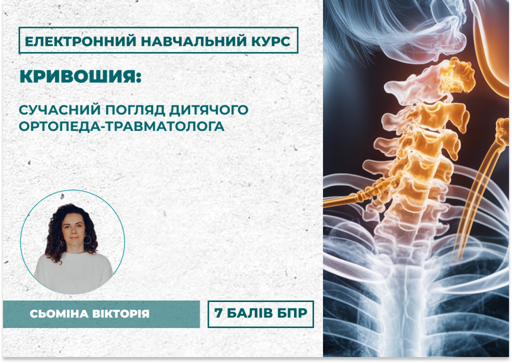 ЕНК: Кривошия: сучасний погляд дитячого ортопеда-травматолога