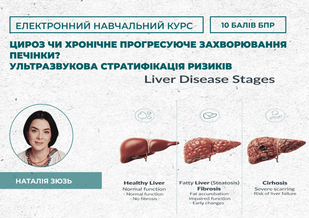 ЕНК: Цироз чи хронічне прогресуюче захворювання печінки. Ультразвукова стратифікація ризиків