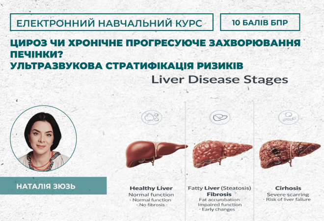 Цироз чи хронічне прогресуюче за (1)