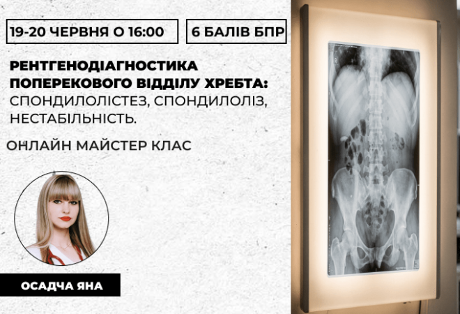 Рентгенодіагностика поперековог