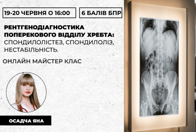 Рентгенодіагностика поперековог