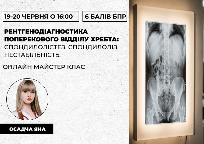 Рентгенодіагностика поперековог