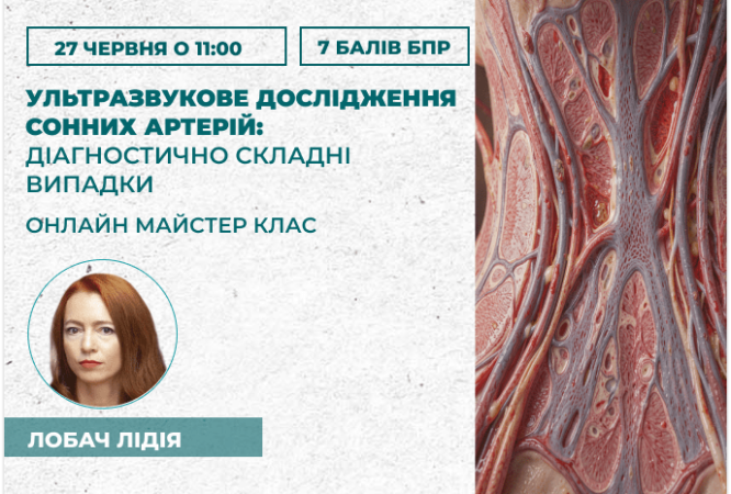 Ультразвукове дослідження сонних