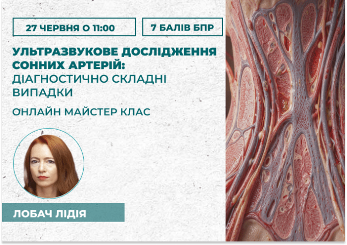 Ультразвукове дослідження сонних