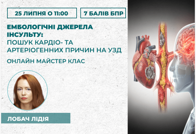 Ембологічні джерела інсульту_ п