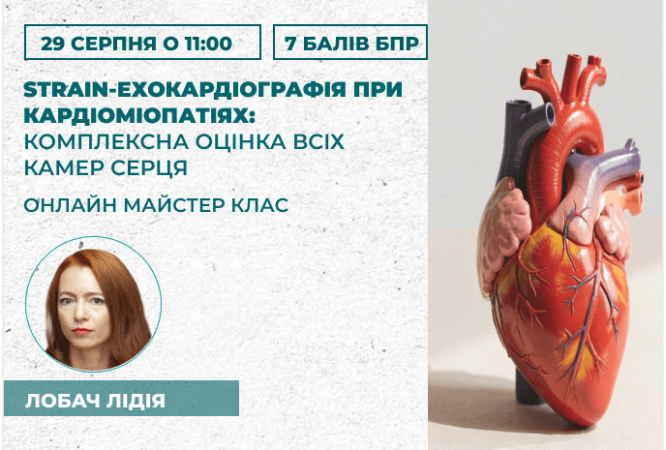 Strain-ехокардіографія при карді
