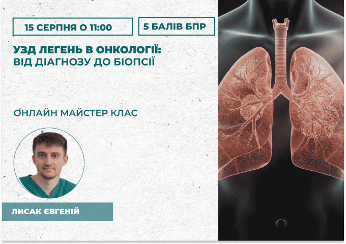 УЗД легень в онкології_ від діаг