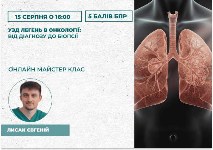 УЗД легень в онкології_ від діаг